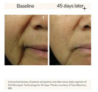 Biopelle Repair & Restore Skin Kit
