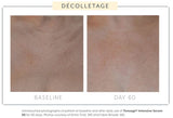 Biopelle Tensage Intensive Serum 50 10x 1.5mL tubes