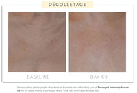 Biopelle Tensage Intensive Serum 50 10x 1.5mL tubes
